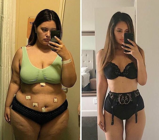 Flicka före och efter viktminskning med kapslar KETO Complete
